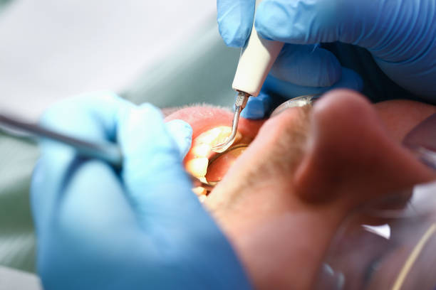 Best Tooth Infection Emergency Dentist  in East Canton, OH