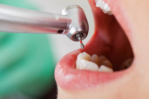 Best Tooth Pain Emergency Relief  in East Canton, OH
